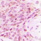 Anti-POLR2E Antibody